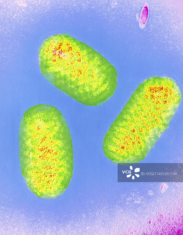 牛痘病毒颗粒的伪色透射电子显微镜图像图片素材