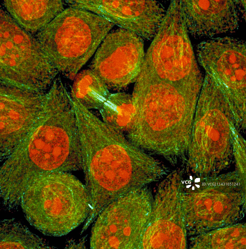 HeLa癌细胞的免疫荧光LM图片素材