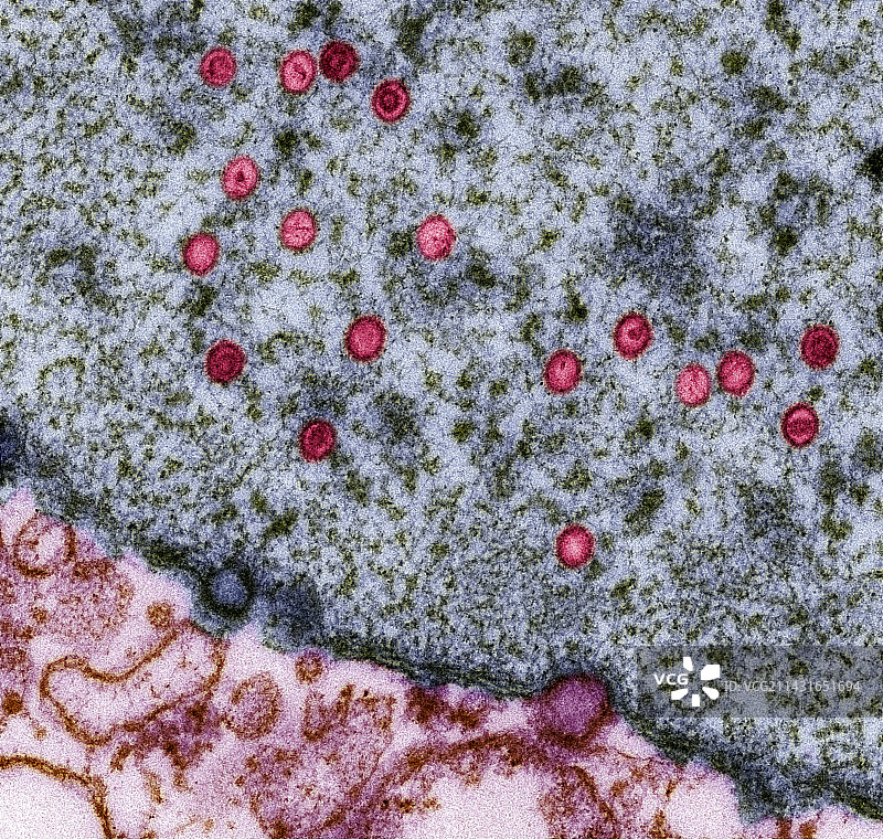 EB病毒颗粒（透射电镜）图片素材