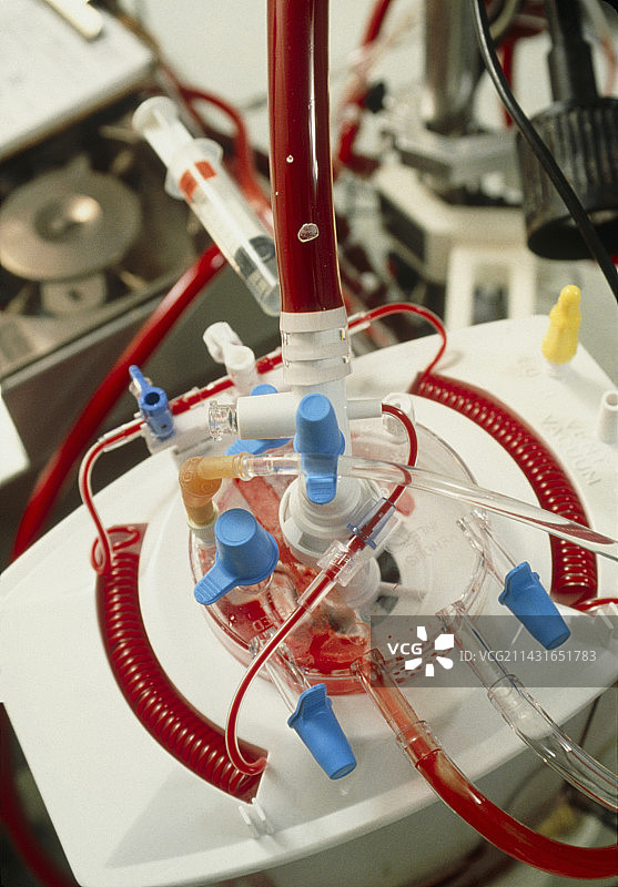 心脏手术期间的心肺机图片素材