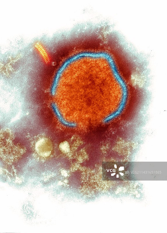 麻疹病毒（TEM）图片素材