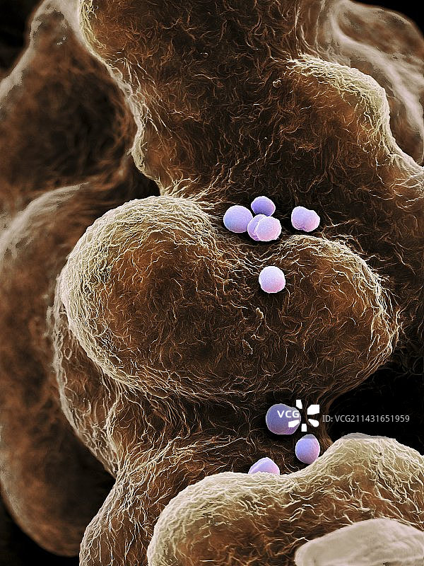 耐甲氧西林金黄色葡萄球菌，扫描电镜图片素材