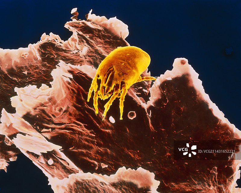 尘螨和头皮屑的彩色扫描电镜图像图片素材