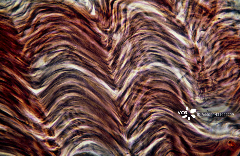 平滑肌组织的光学显微照片图片素材