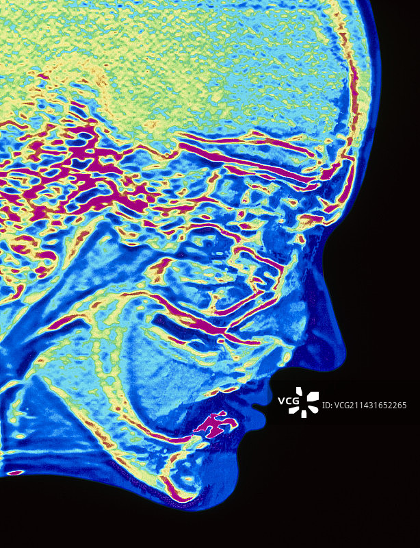 健康人头部核磁共振彩色扫描图图片素材
