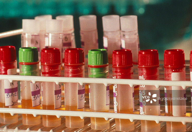 血液制品：人血清试管图片素材