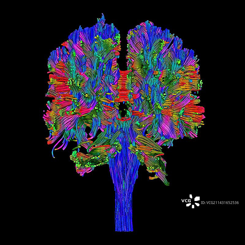 白质纤维DTI扫描图片素材