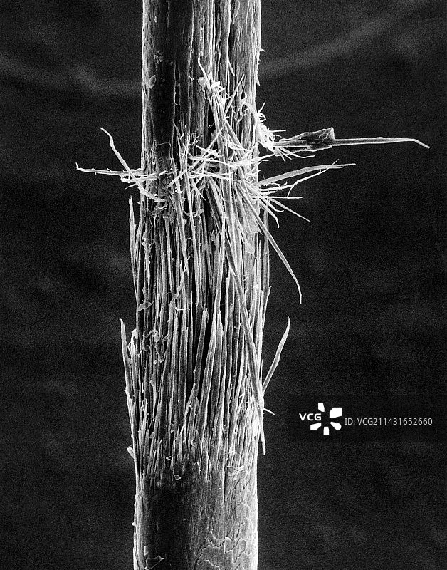 受损的头发，扫描电子显微镜图图片素材