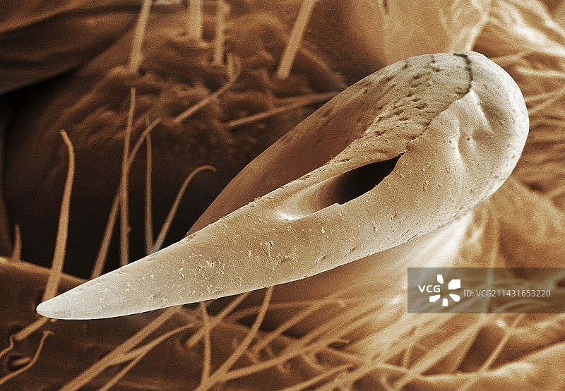 雄性臭虫交配器官（扫描电子显微镜）图片素材