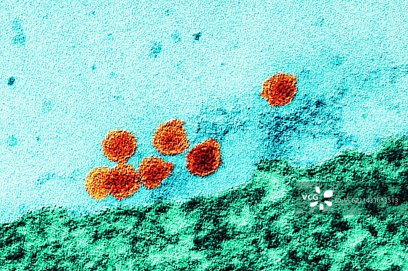 西尼罗河病毒，TEM图片素材