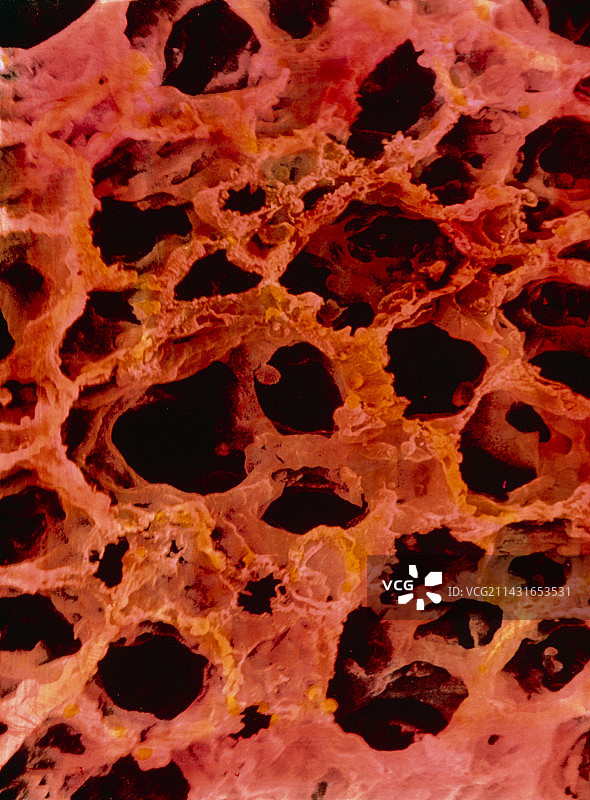 人肺泡管和肺泡的扫描电镜图图片素材