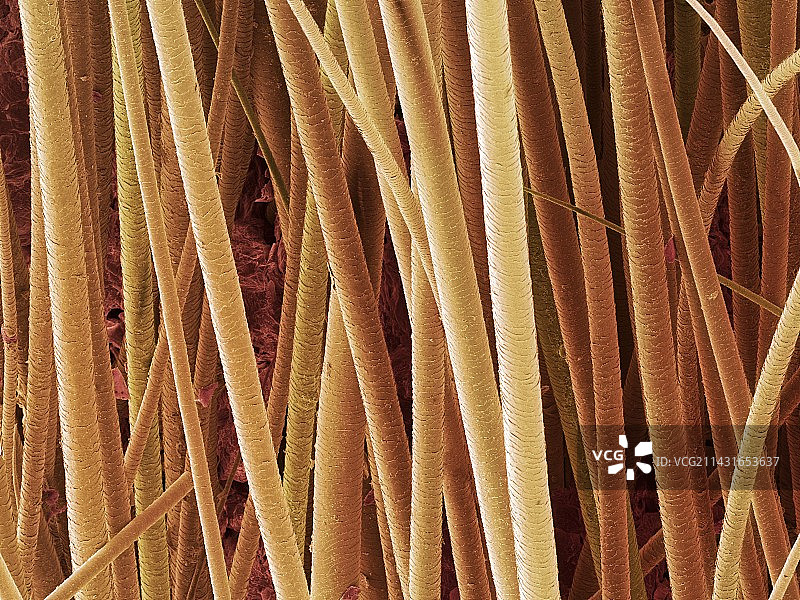 人类头发扫描电镜图图片素材