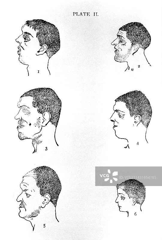 罪犯颅相学研究图片素材
