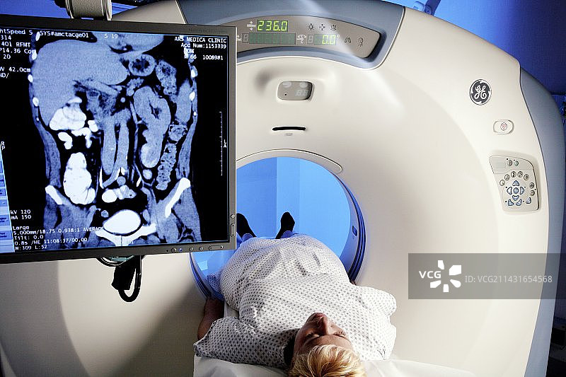 CT扫描图片素材