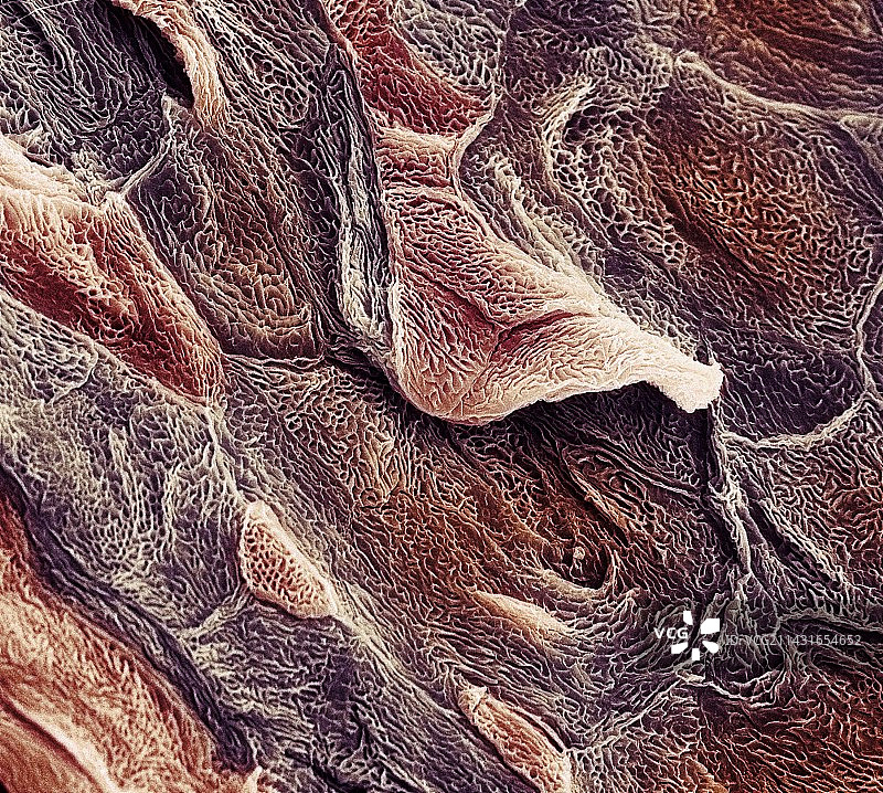 皮肤表面扫描电镜图图片素材