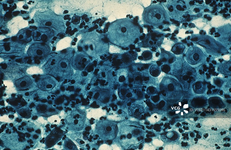 更年期阴道细胞图片素材