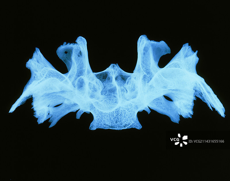 人蝶骨的X光图像图片素材