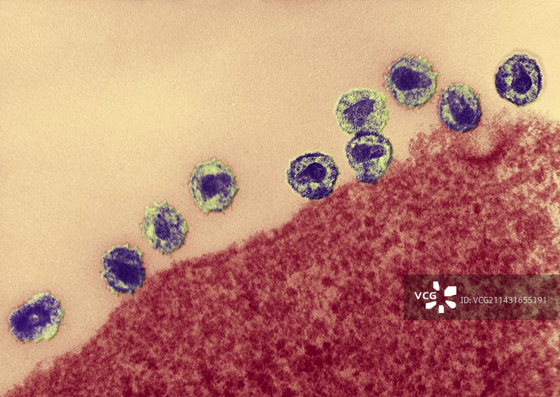 感染HIV的细胞，透射电镜图片素材