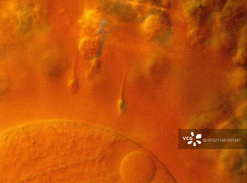 试管婴儿中精子和卵子结合的光学显微镜图图片素材