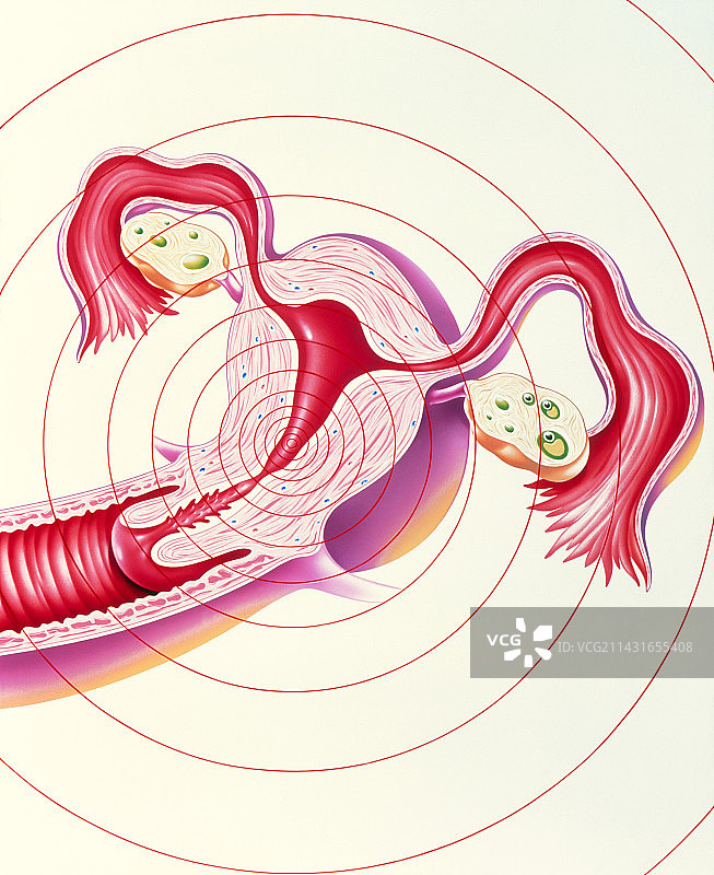 子宫遭受月经疼痛的艺术作品图片素材