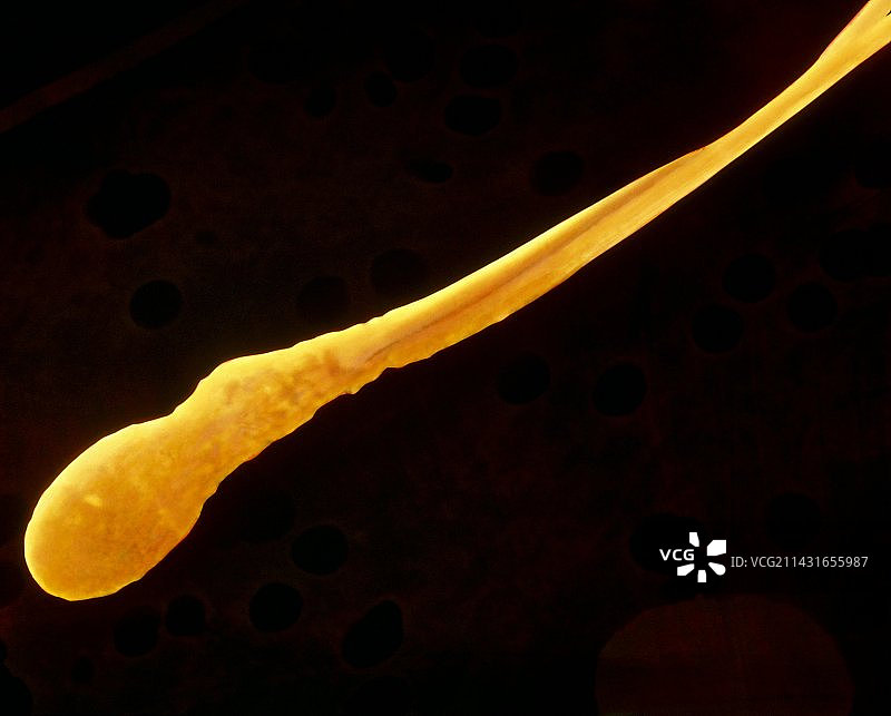 显示畸形精子的彩色扫描电镜图（双体）图片素材
