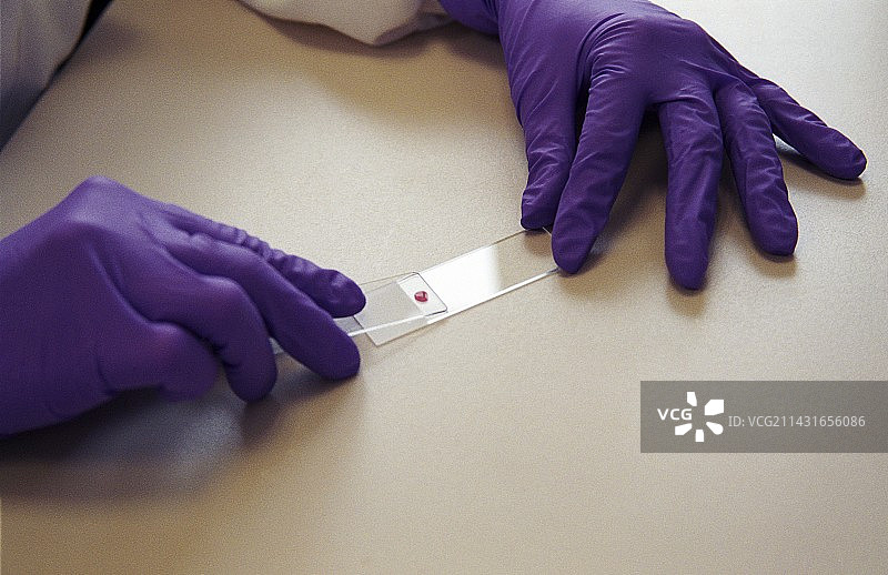 准备血涂片图片素材