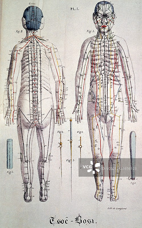 针灸图解图片素材