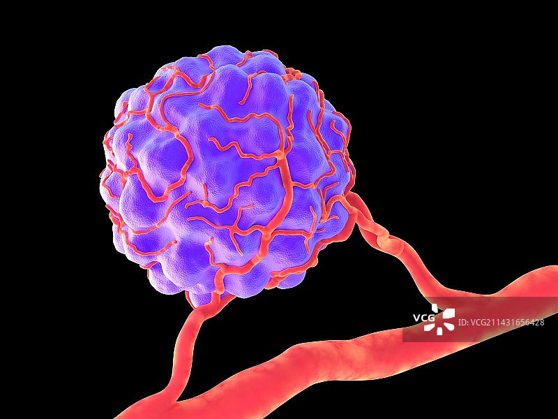 肿瘤，艺术作品图片素材