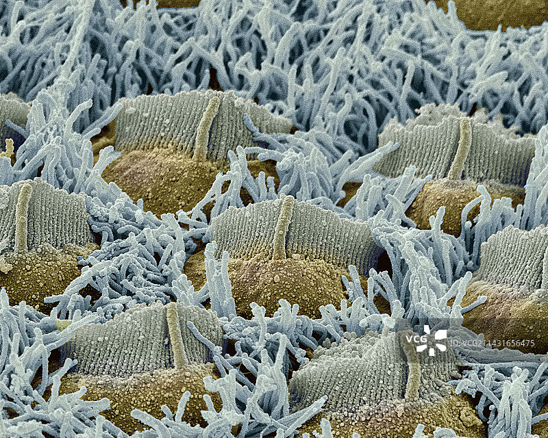 胎儿内耳毛细胞扫描电镜图图片素材