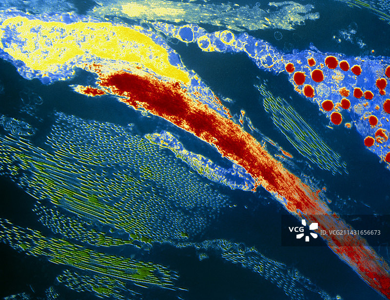 弹性蛋白、成纤维细胞和胶原蛋白彩色TEM图像图片素材