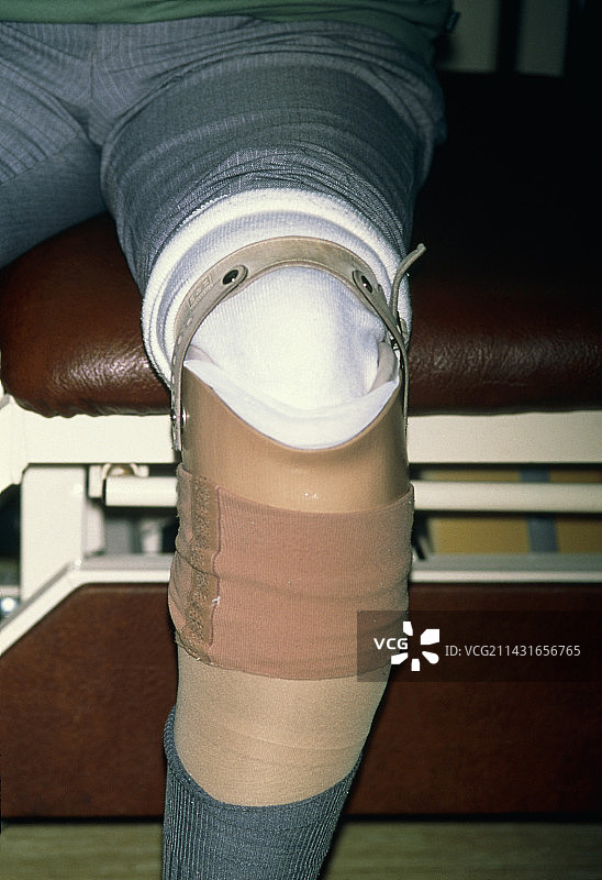 男人的假肢小腿图片素材