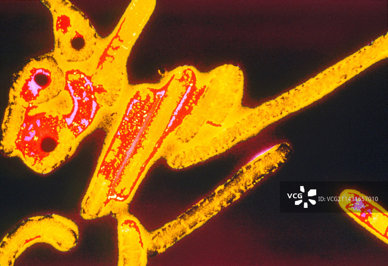 埃博拉病毒的彩色透射电镜图图片素材