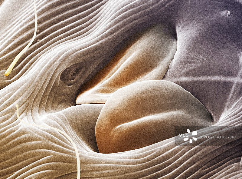 尘螨生殖器，彩色扫描电镜图片素材