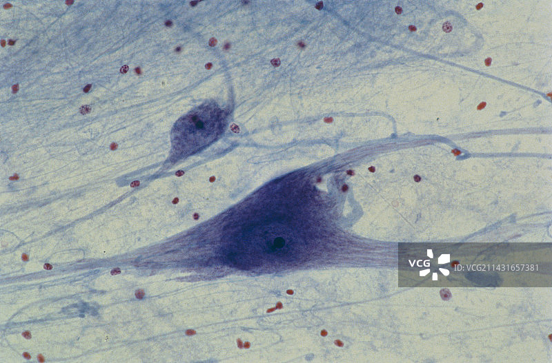 人类脊髓的显微照片图片素材