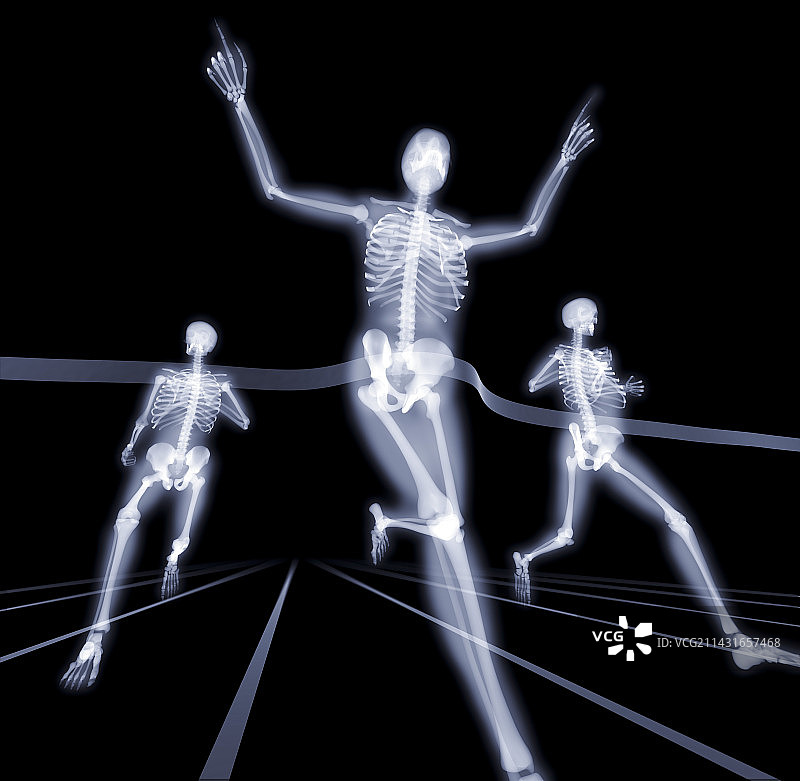 赢得比赛的X光片图片素材