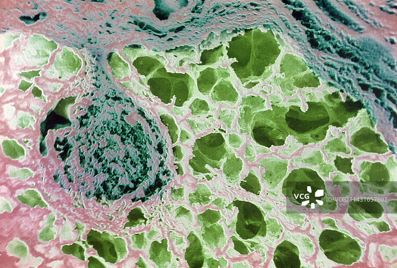 肺泡和微动脉扫描电镜图图片素材