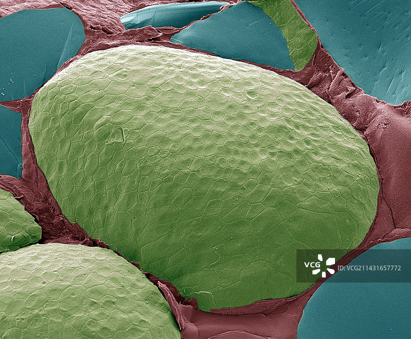 甲状腺，扫描电子显微镜图片素材