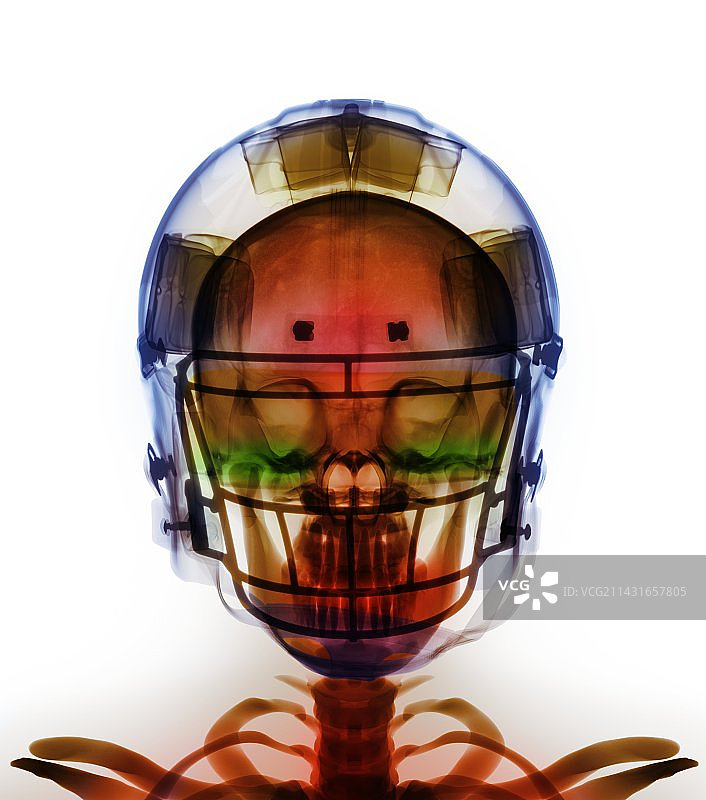 美式橄榄球头盔X光片图片素材