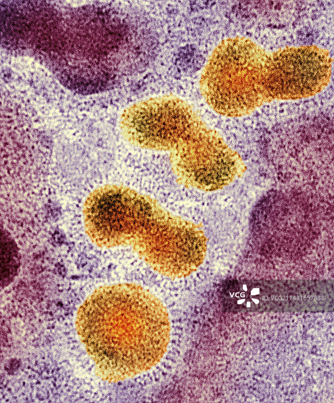 H5N1禽流感病毒颗粒（透射电镜）图片素材