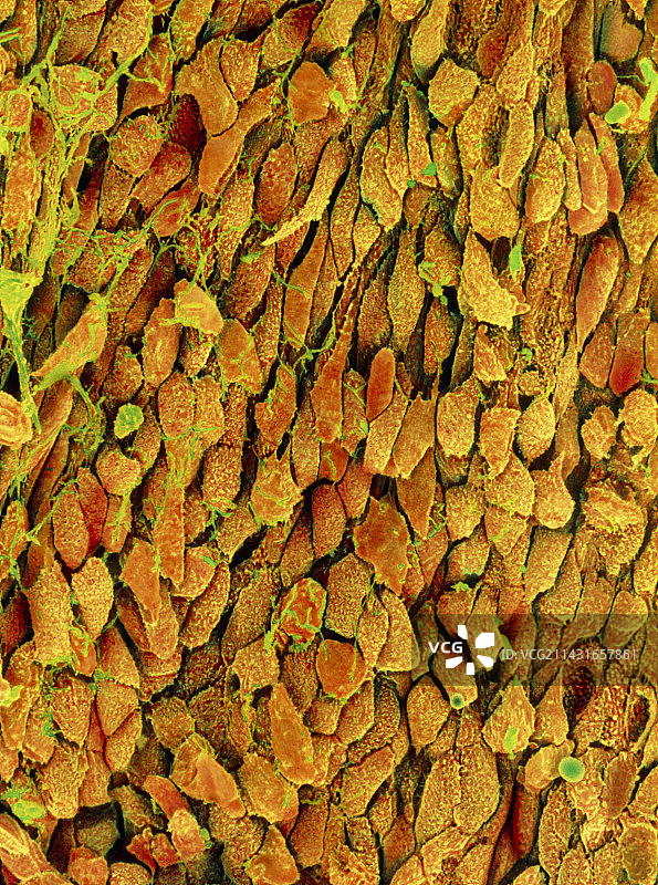 人膀胱上皮细胞的彩色扫描电镜图图片素材