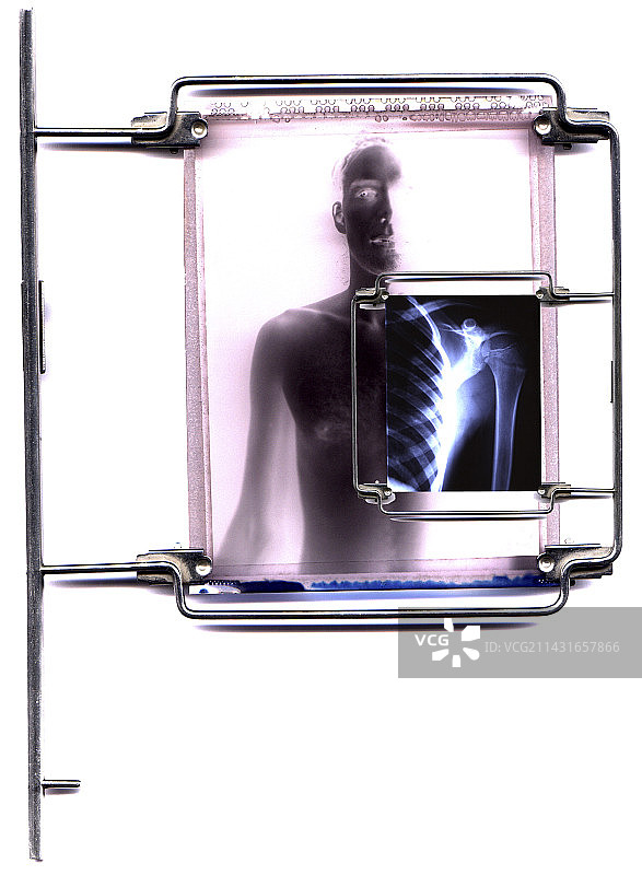 诊断影像图片素材