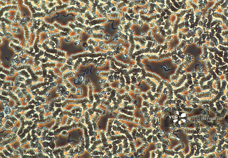 昏睡病寄生虫图片素材