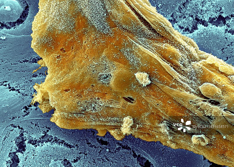 干细胞，扫描电子显微镜图片素材