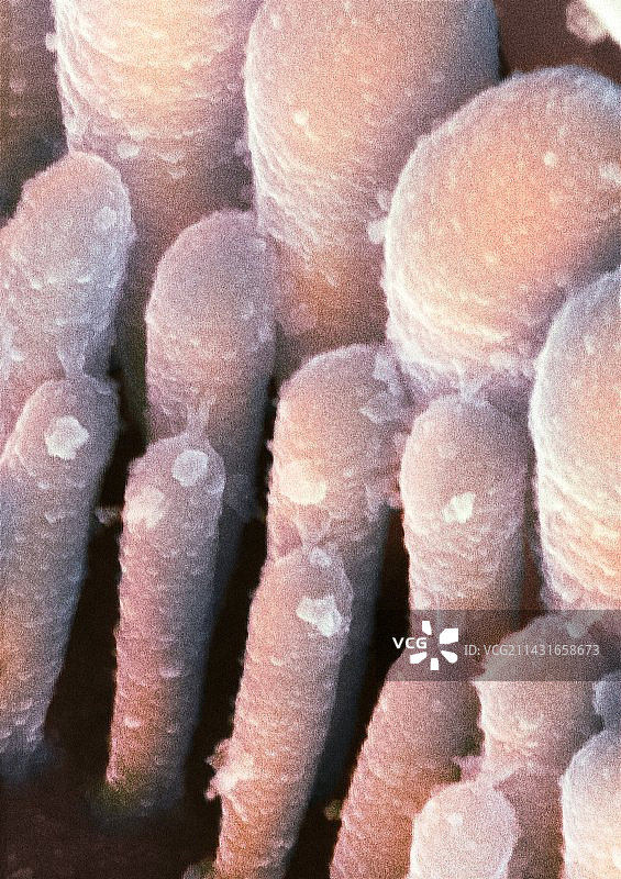 内耳毛细胞扫描电镜图图片素材