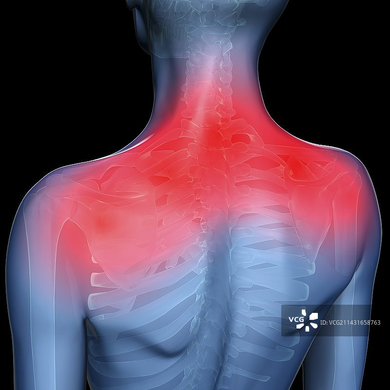 肩部疼痛概念艺术作品图片素材