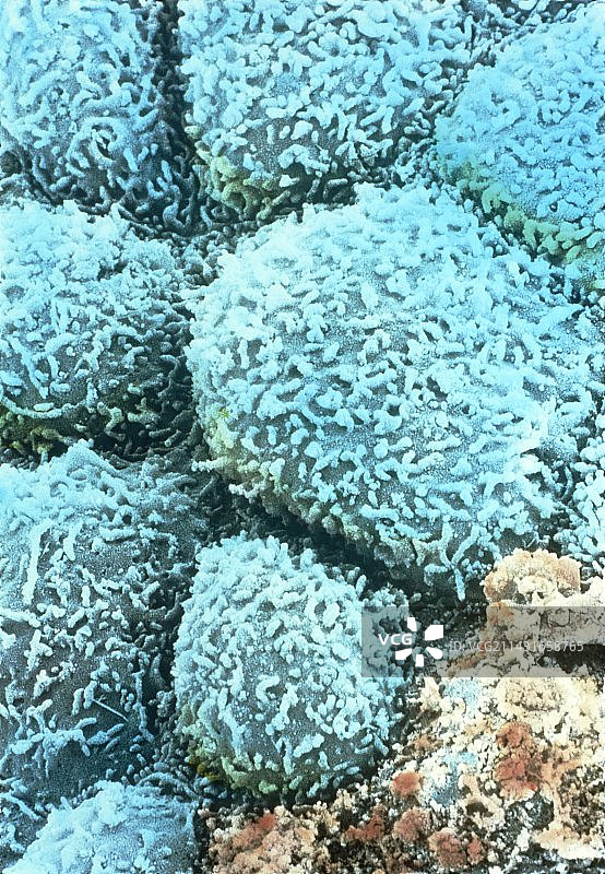 更年期子宫图片素材