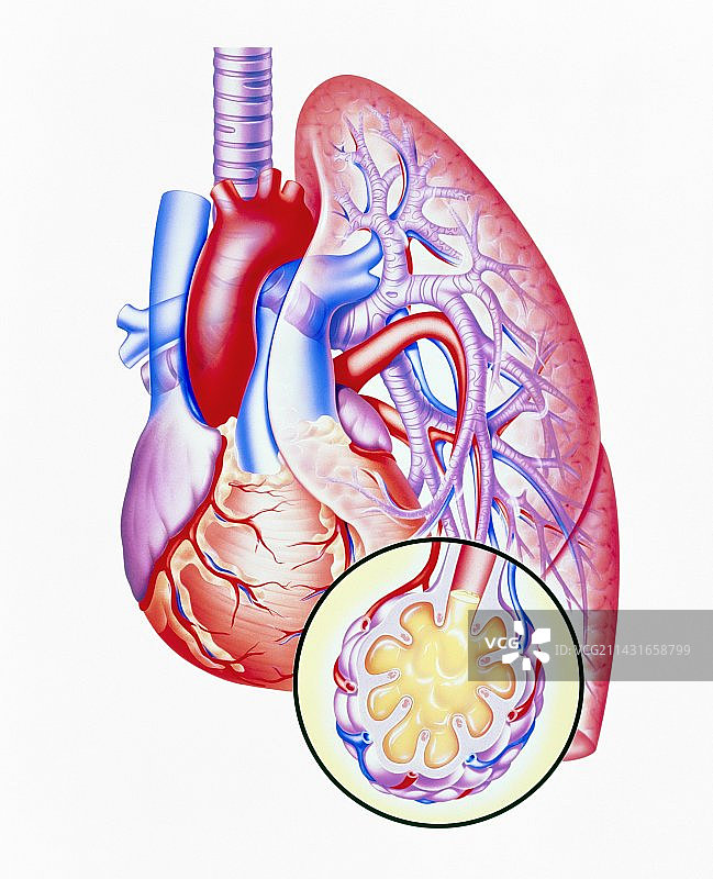 心力衰竭引起的肺水肿艺术插画图片素材