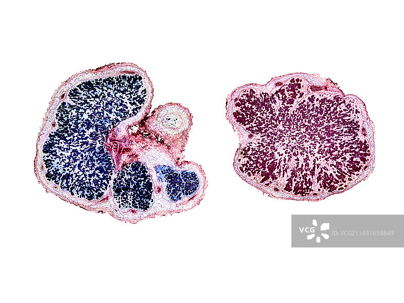 豆科植物根瘤，光学显微照片图片素材