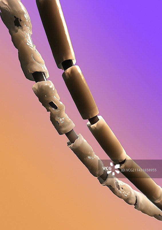 多发性硬化症中受损的髓磷脂艺术图图片素材