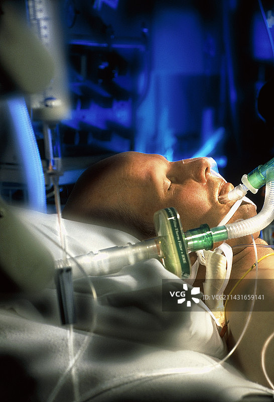 在心脏重症监护室戴着呼吸器的男人图片素材